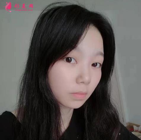 上海九院下頜角磨骨怎么樣？特色技術(shù)分析和案例效果圖匯總！你評評效果如何