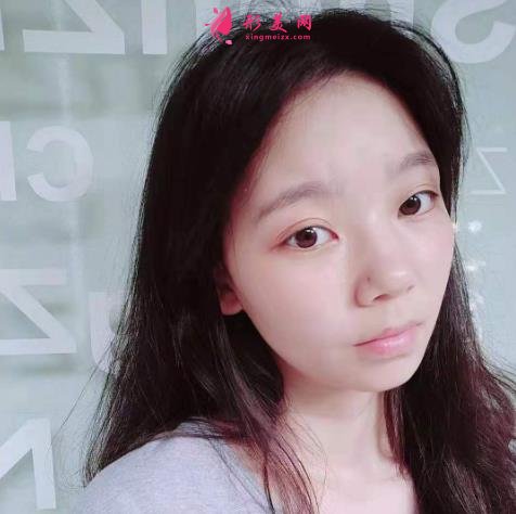 上海九院下頜角磨骨怎么樣？特色技術(shù)分析和案例效果圖匯總！你評評效果如何