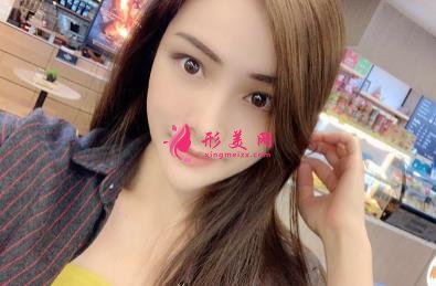 寧波壹加壹整形醫(yī)院怎么樣？從簡介及激光去眼袋案例、價格收費可以看出
