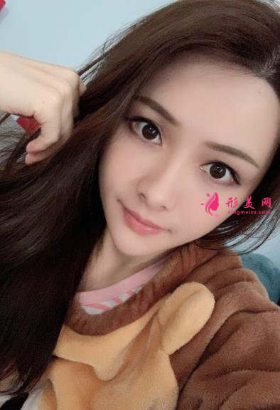 寧波壹加壹整形醫(yī)院怎么樣？從簡介及激光去眼袋案例、價格收費可以看出