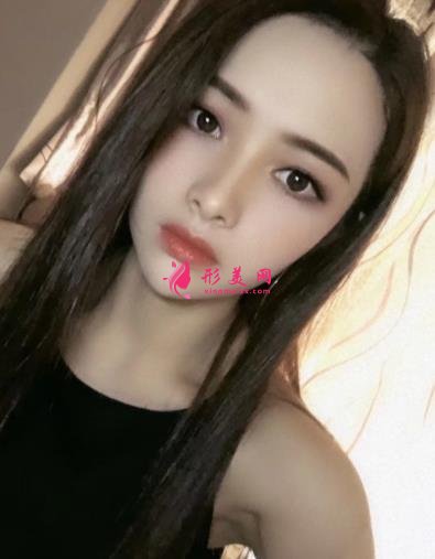寧波壹加壹整形醫(yī)院怎么樣？從簡介及激光去眼袋案例、價格收費可以看出