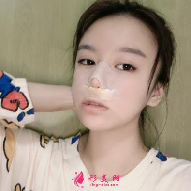蘇州昆山百達(dá)麗醫(yī)療美容靠譜嗎？做鼻子真實(shí)案例及價(jià)目表_口碑介紹