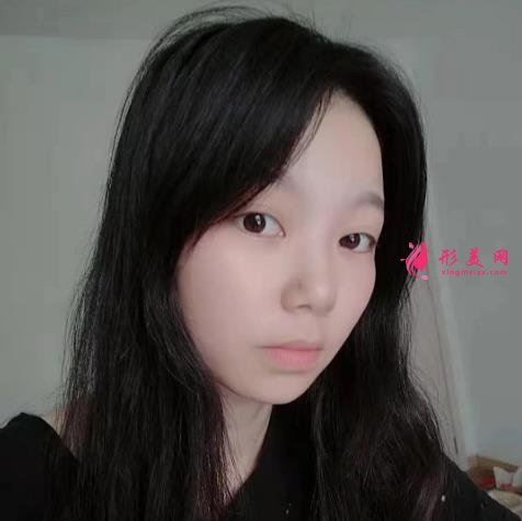 上海九院下頜角磨骨怎么樣？特色技術(shù)分析和案例效果圖匯總！你評評效果如何