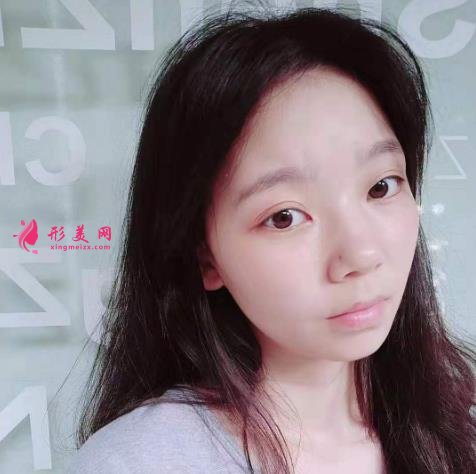 上海九院下頜角磨骨怎么樣？特色技術(shù)分析和案例效果圖匯總！你評評效果如何