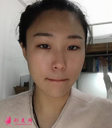 淮安市第一人民醫(yī)院整形科怎么樣?瘦臉針案例+價格價目表分享