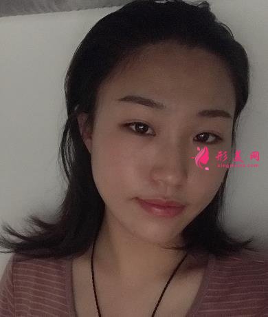 淮安市第一人民醫(yī)院整形科怎么樣?瘦臉針案例+價格價目表分享