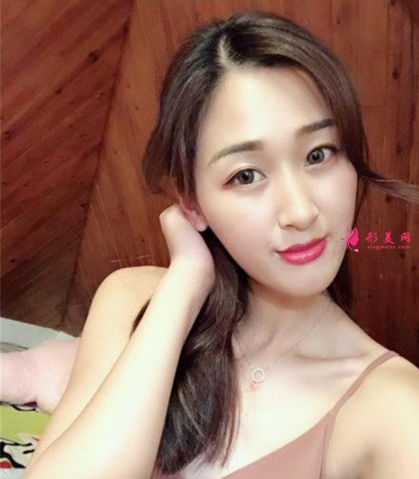 天津醫(yī)院鼻綜合怎么樣？鼻翼縮小手術(shù)適合人群及價(jià)格分享