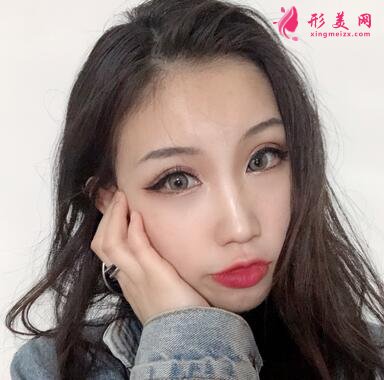 成都八大處整形醫(yī)院隆鼻案例曝光！還有價(jià)格收費(fèi)明細(xì)參考