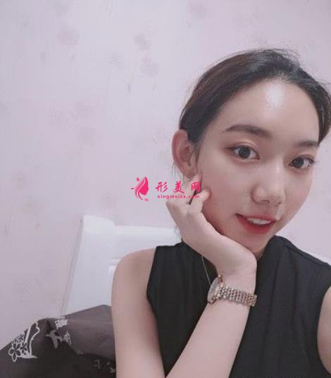 北京純脂孫澤芳面部填充脂肪案例反饋!整形價(jià)格全面一覽