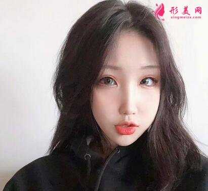 上海九院整形科價格(價目)表全新出爐!隆鼻案例反饋~
