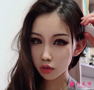 上海九院整形科價格(價目)表全新出爐!隆鼻案例反饋~