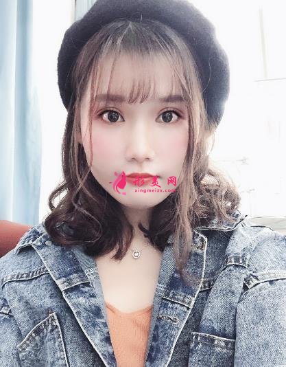 中日友好醫(yī)院整形科雙眼皮怎么樣？開眼角留疤了怎么辦？