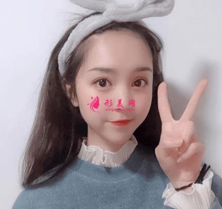 西安西京醫(yī)院雙眼皮怎么樣？為什么開內(nèi)眼角手術(shù)后眼角縮回？