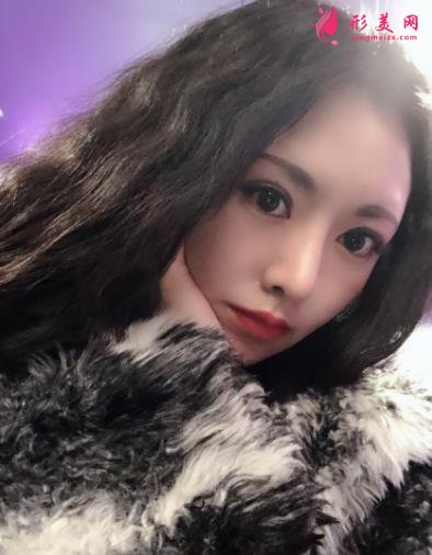 成都新麗美整形醫(yī)院隆鼻怎么樣？口碑案例和正規(guī)費(fèi)用（價(jià)格表）一覽