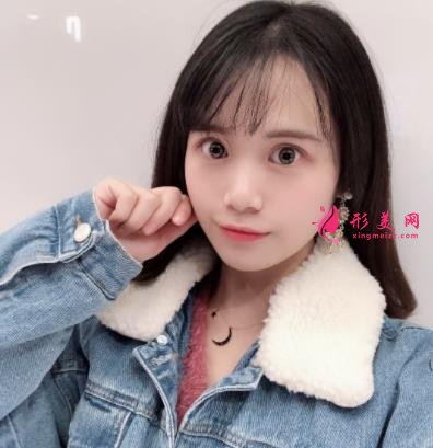 洛陽三院美容科做雙眼皮怎么樣？真實案例恢復圖及價目價格全面了解