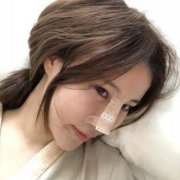 杭州整形醫(yī)院做隆鼻怎么樣？專家案例及價格價錢表反饋