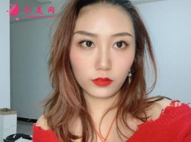 鄭東美眼醫(yī)療美容怎么樣？雙眼皮案例效果反饋圖及價(jià)格費(fèi)用清單查詢