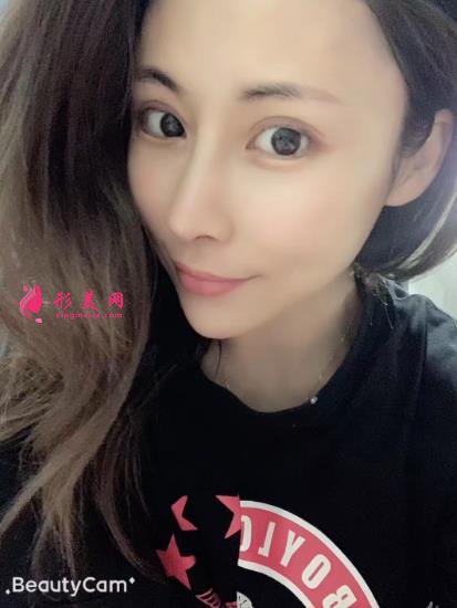 上海伯思立沈國雄鼻修復(fù)怎么樣？專家案例和價(jià)格表參考如下！