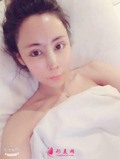 上海伯思立沈國雄鼻修復(fù)怎么樣？專家案例和價(jià)格表參考如下！