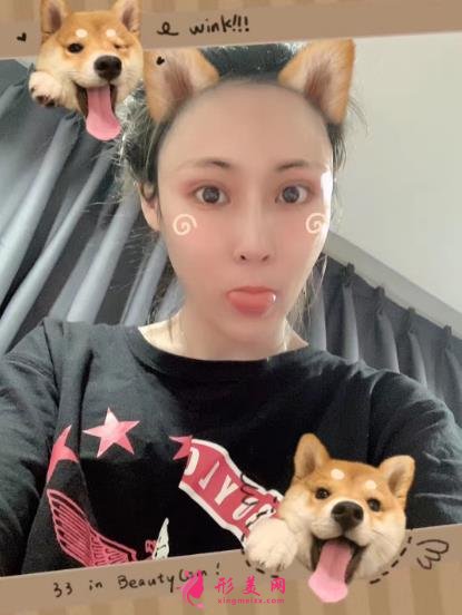 上海伯思立沈國雄鼻修復(fù)怎么樣？專家案例和價(jià)格表參考如下！