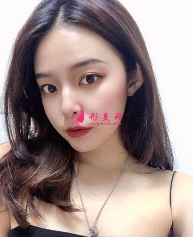 長春海峽整形醫(yī)院植發(fā)咋樣？案例效果_價格收費(fèi)表請查收~