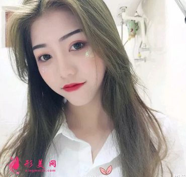 安徽合肥韓美整形醫(yī)院雙眼皮案例_價格(收費)表明細查收~