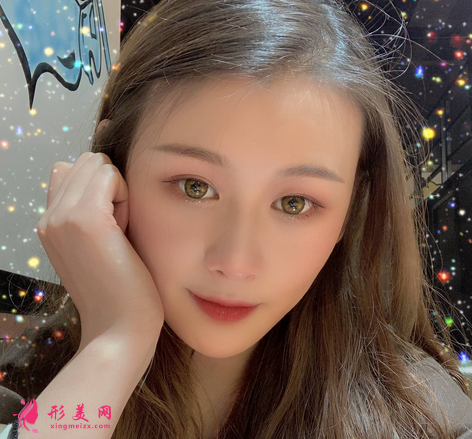佛山禪城中心醫(yī)院整形磨骨咋樣？案例效果反饋_整形價(jià)格同步一覽