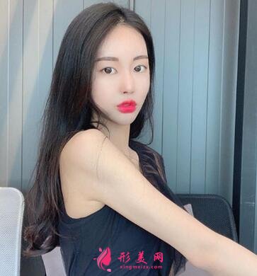 北京八大處整形醫(yī)院熱瑪吉怎么樣？案例_價(jià)格表收費(fèi)標(biāo)準(zhǔn)一覽