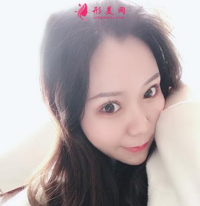 天津公安醫(yī)院雙眼皮怎么樣？手術(shù)恢復過程分享_價格在線查詢