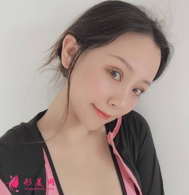 天津公安醫(yī)院雙眼皮怎么樣？手術(shù)恢復過程分享_價格在線查詢