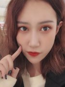 上海伊萊美醫(yī)療美容醫(yī)院做雙眼皮怎么樣？案例真實(shí)反饋_整形價(jià)格