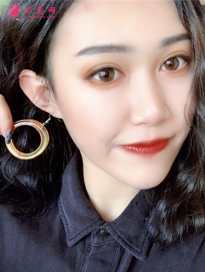 上海伊萊美醫(yī)療美容醫(yī)院做雙眼皮怎么樣？案例真實反饋_整形價格一覽