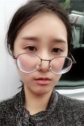 無(wú)錫曼陀羅醫(yī)院上臉下垂矯正案例_整形美容價(jià)格表請(qǐng)查收！