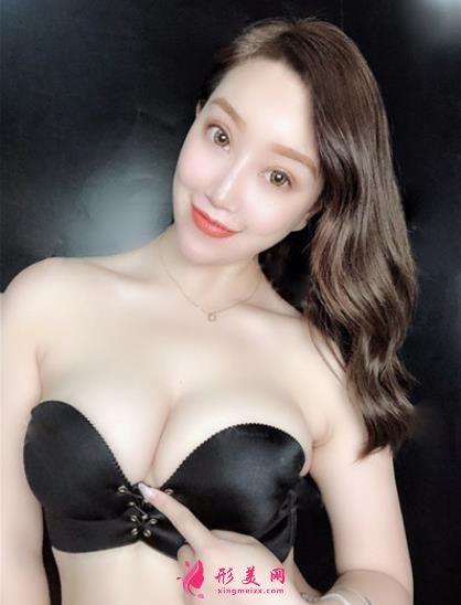 北京301醫(yī)院陳猶白取奧美定怎么樣？案例圖術(shù)后恢復(fù)記錄新公開