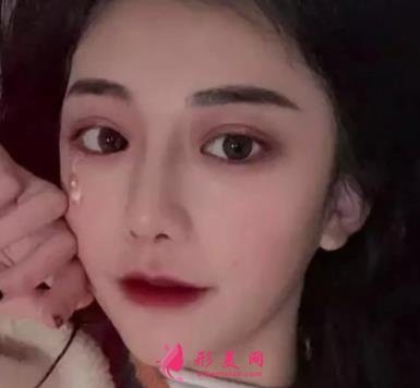 常州一院整形科做鼻子價(jià)格表2021！在分享真實(shí)案例效果圖