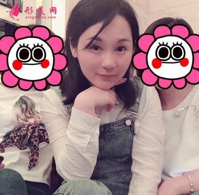 四川華西醫(yī)院整形科玻尿酸豐太陽穴案例查詢！含2022全新價(jià)格表公
