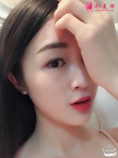 長(zhǎng)沙湘雅三院整形科怎么樣？全新隆鼻案例及價(jià)格價(jià)目表對(duì)比盤(pán)點(diǎn)