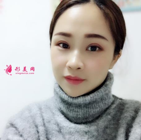 深圳北大醫(yī)院整形科做雙眼皮怎么樣？案例及價(jià)格表（多少錢）在線參考