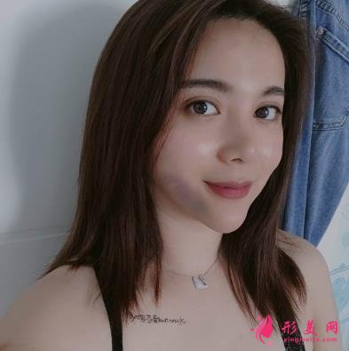 上海長(zhǎng)征醫(yī)院整形科面部吸脂怎么樣？術(shù)后瘦臉效果跟美顏相機(jī)說(shuō)再見(jiàn)！
