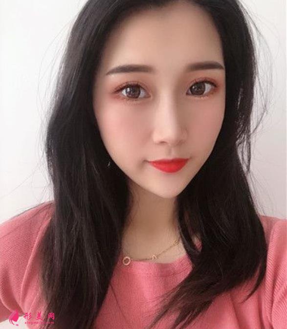 溫州藝星整形美容醫(yī)院做隆鼻怎么樣？好不好？專家案例價(jià)格收費(fèi)一覽