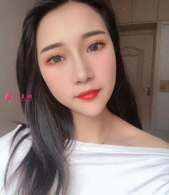 溫州藝星整形美容醫(yī)院做隆鼻怎么樣？好不好？專家案例價(jià)格收費(fèi)一覽