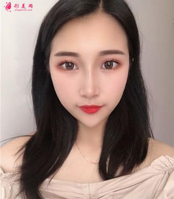 溫州藝星整形美容醫(yī)院做隆鼻怎么樣？好不好？專家案例價(jià)格收費(fèi)一覽