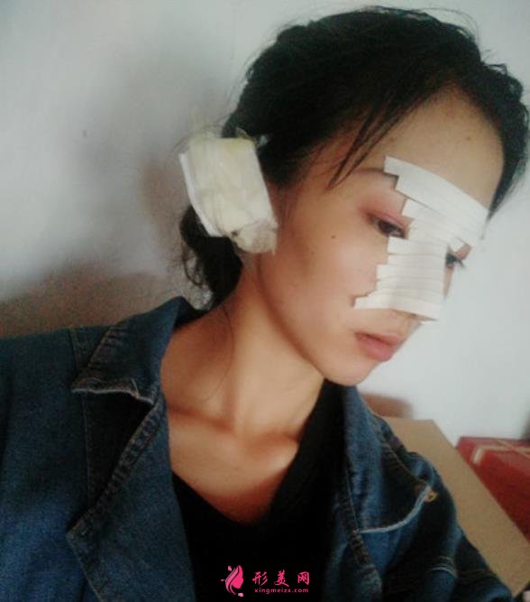 武漢同濟醫(yī)院整形科（公立）價格收費標準更新！隆鼻案例全面公開~