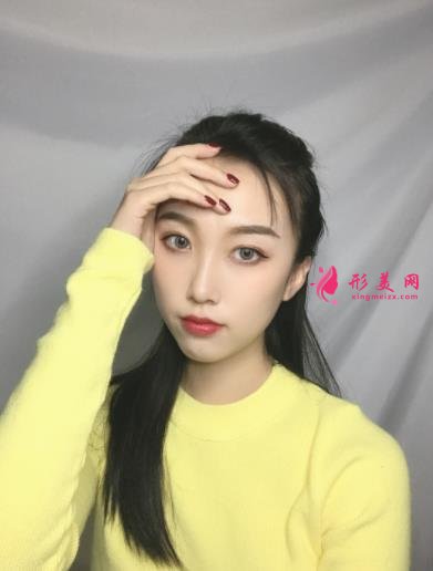 云南省中醫(yī)院美容科怎么樣?看專家顴骨案例及部分項目價格表收費明細