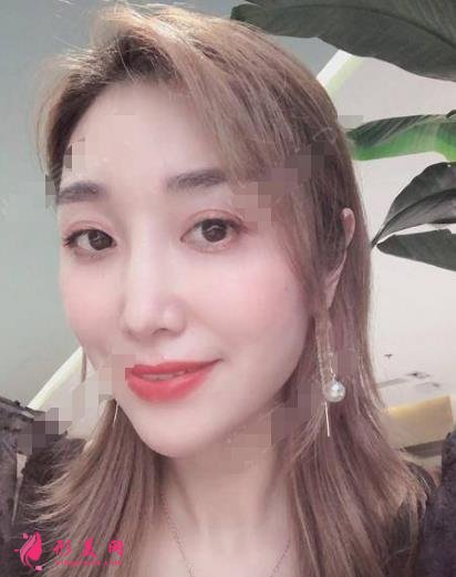 衡水整形醫(yī)院哪家好？排名前三口碑推薦_含除皺（頸紋）案例效果圖
