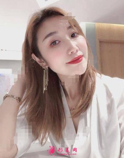 衡水整形醫(yī)院哪家好？排名前三口碑推薦_含除皺（頸紋）案例效果圖