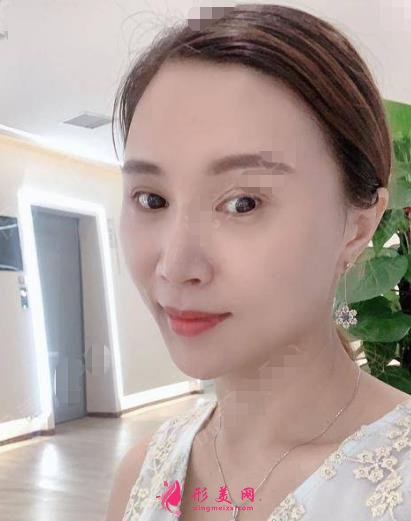 松原口碑好的整形醫(yī)院有哪些？排名前三權(quán)威發(fā)布_陽光、海峽實力領(lǐng)銜