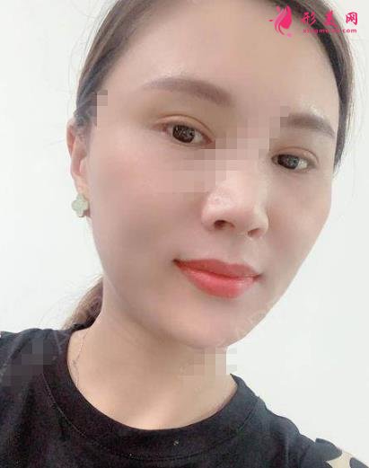松原口碑好的整形醫(yī)院有哪些？排名前三權(quán)威發(fā)布_陽光、海峽實力領(lǐng)銜