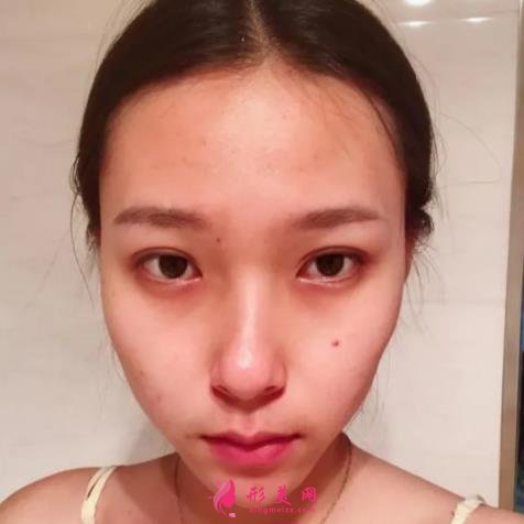 江西豐城整形美容院哪個(gè)好？排名前三口碑機(jī)構(gòu)推薦_丁宇實(shí)力領(lǐng)銜