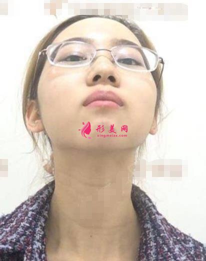 東營(yíng)整形醫(yī)院哪家好？排名前三口碑機(jī)構(gòu)盤(pán)點(diǎn)_含除皺恢復(fù)效果圖